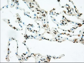 Anti-CD147 antibody [4E4] used in IHC (Paraffin sections) (IHC-P). GTX84798