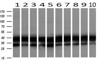 Anti-CD147 antibody [9H5] used in Western Blot (WB). GTX84801