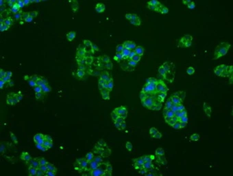 Anti-B-Raf antibody [1E2] used in Immunocytochemistry/ Immunofluorescence (ICC/IF). GTX84806