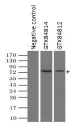 Anti-B-Raf antibody [4B2] used in Immunoprecipitation (IP). GTX84814