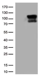 Anti-B-Raf antibody [4B2] used in Western Blot (WB). GTX84814