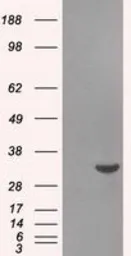 Anti-Livin antibody [1B10] used in Western Blot (WB). GTX84822