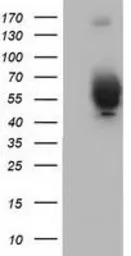 Anti-Bestrophin 3 antibody [1B6] used in Western Blot (WB). GTX84830