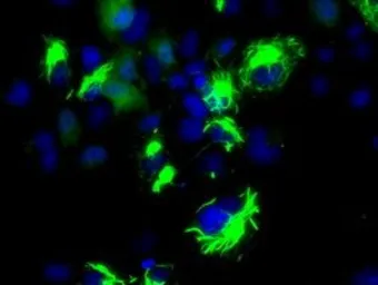 Anti-BCL10 antibody [4A8] used in Immunocytochemistry/ Immunofluorescence (ICC/IF). GTX84835