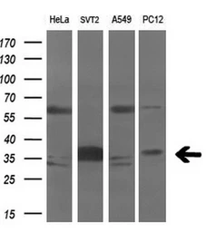 Anti-Aurora C antibody [2B7] used in Western Blot (WB). GTX84840