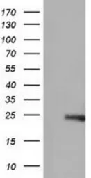 Anti-Rho GDI alpha antibody [1F2] used in Western Blot (WB). GTX84859