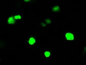 Anti-Rho GDI alpha antibody [1A7] used in Immunocytochemistry/ Immunofluorescence (ICC/IF). GTX84860