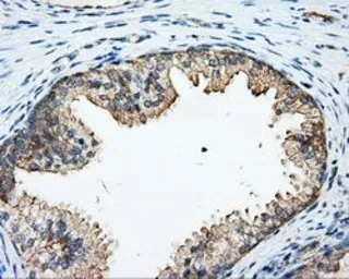 Anti-Rho GDI alpha antibody [1A7] used in IHC (Paraffin sections) (IHC-P). GTX84860