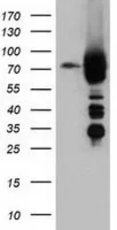 Anti-ARHGAP25 antibody [3G1] used in Western Blot (WB). GTX84863