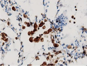 Anti-ARHGAP25 antibody [12G4] used in IHC (Paraffin sections) (IHC-P). GTX84867