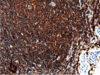 Anti-ARHGAP25 antibody [12G4] used in IHC (Paraffin sections) (IHC-P). GTX84867