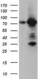 Anti-ARHGAP25 antibody [12G4] used in Western Blot (WB). GTX84867