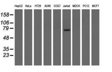 Anti-ARHGAP25 antibody [12G4] used in Western Blot (WB). GTX84867