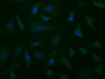 Anti-ALDH1L1 antibody [7B7] used in Immunocytochemistry/ Immunofluorescence (ICC/IF). GTX84895