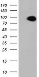Anti-ALDH1L1 antibody [1H6] used in Western Blot (WB). GTX84897