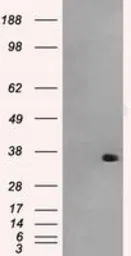 Anti-AKR1A1 antibody [8H2] used in Western Blot (WB). GTX84915