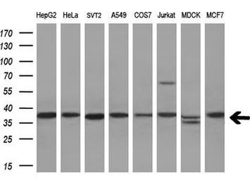 Anti-AKR1A1 antibody [9F1] used in Western Blot (WB). GTX84918