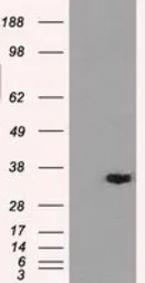 Anti-AKR1A1 antibody [9F1] used in Western Blot (WB). GTX84918