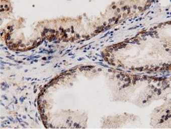 Anti-AK5 antibody [2F9] used in IHC (Paraffin sections) (IHC-P). GTX84921