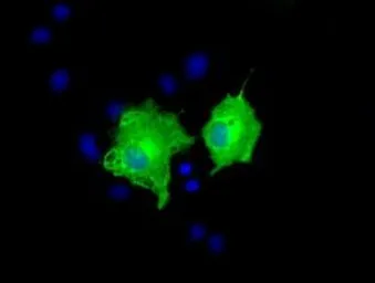 Anti-AK5 antibody [1D5] used in Immunocytochemistry/ Immunofluorescence (ICC/IF). GTX84922