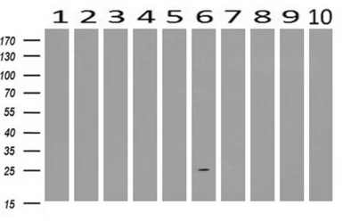 Anti-AK3 antibody [6D6] used in Western Blot (WB). GTX84931