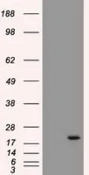 Anti-Adenylate kinase 1 antibody [4A1] used in Western Blot (WB). GTX84936