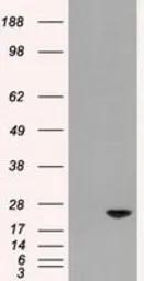 Anti-Adenylate kinase 1 antibody [18C7] used in Western Blot (WB). GTX84937
