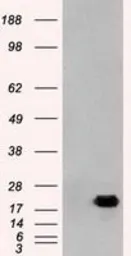 Anti-Adenylate kinase 1 antibody [19D1] used in Western Blot (WB). GTX84939