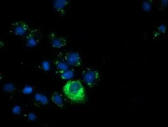 Anti-Alpha fetoprotein / AFP antibody [3G3/2D3] used in Immunocytochemistry/ Immunofluorescence (ICC/IF). GTX84948
