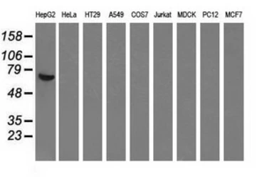 Anti-Alpha fetoprotein / AFP antibody [3G3/2D3] used in Western Blot (WB). GTX84948