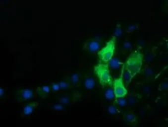 Anti-Alpha fetoprotein / AFP antibody [2A9] used in Immunocytochemistry/ Immunofluorescence (ICC/IF). GTX84954
