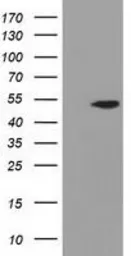 Anti-ADSL antibody [2D10] used in Western Blot (WB). GTX84956