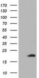 Anti-ADI1 antibody [3H6] used in Western Blot (WB). GTX84958