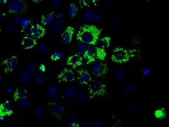 Anti-Aconitase 2 antibody [7A11] used in Immunocytochemistry/ Immunofluorescence (ICC/IF). GTX84966