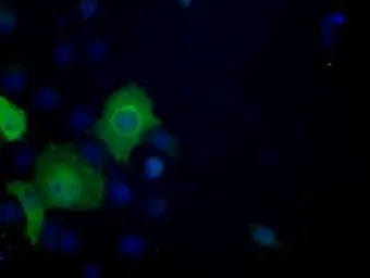Anti-ATP citrate lyase antibody [3G8] used in Immunocytochemistry/ Immunofluorescence (ICC/IF). GTX84967