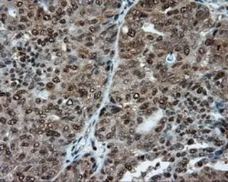 Anti-ATP citrate lyase antibody [3G8] used in IHC (Paraffin sections) (IHC-P). GTX84967
