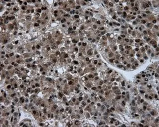 Anti-ATP citrate lyase antibody [3G8] used in IHC (Paraffin sections) (IHC-P). GTX84967