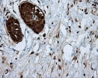 Anti-ATP citrate lyase antibody [3G8] used in IHC (Paraffin sections) (IHC-P). GTX84967