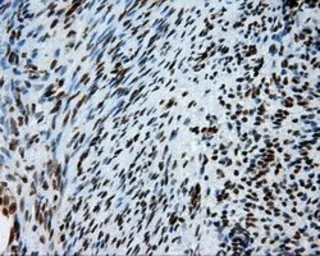 Anti-ATP citrate lyase antibody [3G8] used in IHC (Paraffin sections) (IHC-P). GTX84967