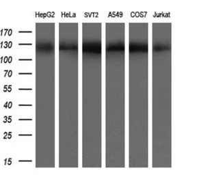 Anti-ATP citrate lyase antibody [3G8] used in Western Blot (WB). GTX84967