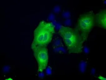 Anti-ACAT2 antibody [1B7] used in Immunocytochemistry/ Immunofluorescence (ICC/IF). GTX84968