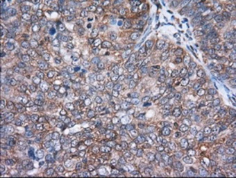 Anti-ACAT2 antibody [1B7] used in IHC (Paraffin sections) (IHC-P). GTX84968