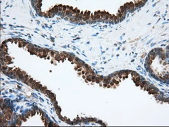 Anti-ACAT2 antibody [1B7] used in IHC (Paraffin sections) (IHC-P). GTX84968