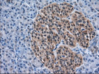 Anti-ACAT2 antibody [1B7] used in IHC (Paraffin sections) (IHC-P). GTX84968