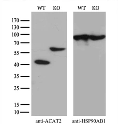 Anti-ACAT2 antibody [1B7] used in Western Blot (WB). GTX84968