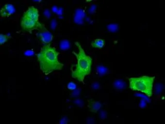 Anti-ACAT2 antibody [3C9] used in Immunocytochemistry/ Immunofluorescence (ICC/IF). GTX84971