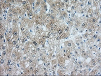 Anti-ACAT2 antibody [3C9] used in IHC (Paraffin sections) (IHC-P). GTX84971