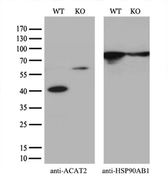 Anti-ACAT2 antibody [3C9] used in Western Blot (WB). GTX84971