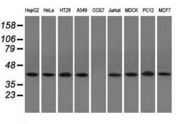 Anti-ACAT2 antibody [3C9] used in Western Blot (WB). GTX84971