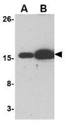 Anti-Bim antibody [1C2C8] used in Western Blot (WB). GTX84981
